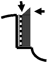 bad-surface-gumming-5-.gif