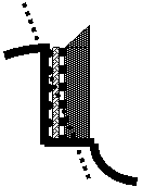 bad-surface-gumming-8-.gif